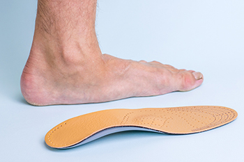  Are Flat Feet Problematic? 