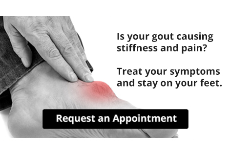 Gout Pain model holding foot