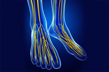 Can Lifestyle Changes Help the Pain From Morton’s Neuroma?