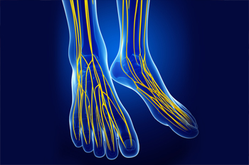  Posterior Tibial Nerve Neuralgia 