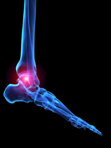 Types of Arthritis in the Feet
