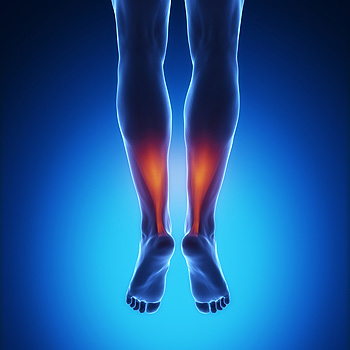  Exercises Can Help Relieve Achilles Tendonitis Pain 