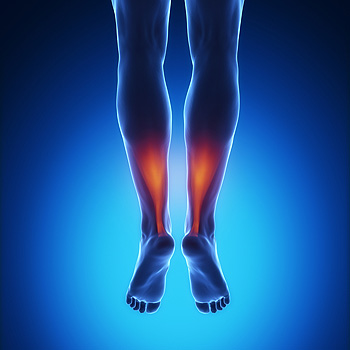 Exercises Can Help Relieve Achilles Tendonitis Pain