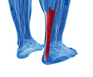 Achilles Tendon Injury infographic