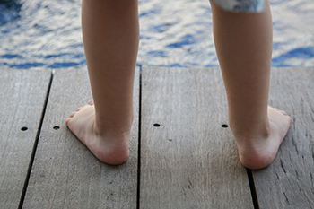 How Pronation Can Affect Runners