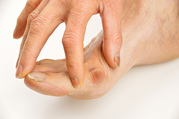  What Is a Tailor’s Bunion? 