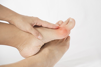 Patient holding foot with Bunions