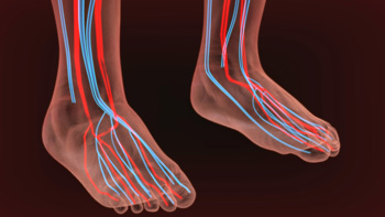 Diagram of Peripheral Artery Disease showing circulation in the feet