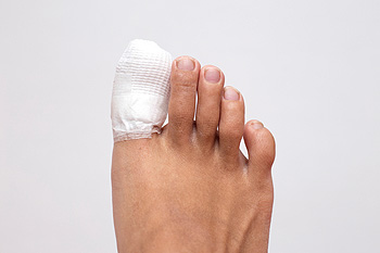 Patient with a wrapped toe